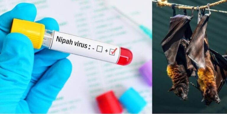 कोरोना से भी ज्यादा खतरनाक है Nipah Virus, अब तक 2 की मौत,  काली हल्दी का use करें